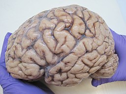 Lateral view of whole human brain held in gloved hands