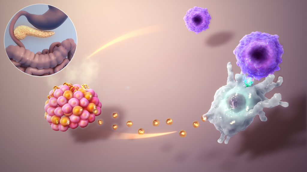 Graphic showing an autoimmune-type attack in which proteins (yellow dots) secreted by the beta cells (orange cluster) are wrongly taken up by dendritic cells (big whitish cell) then presented to T-cells (smaller blue cells). The T-Cells treat those proteins as enemies and attack their producers, the beta cells. The damaged beta cells no longer produce insulin, which can result in diabetic ketoacidosis.
